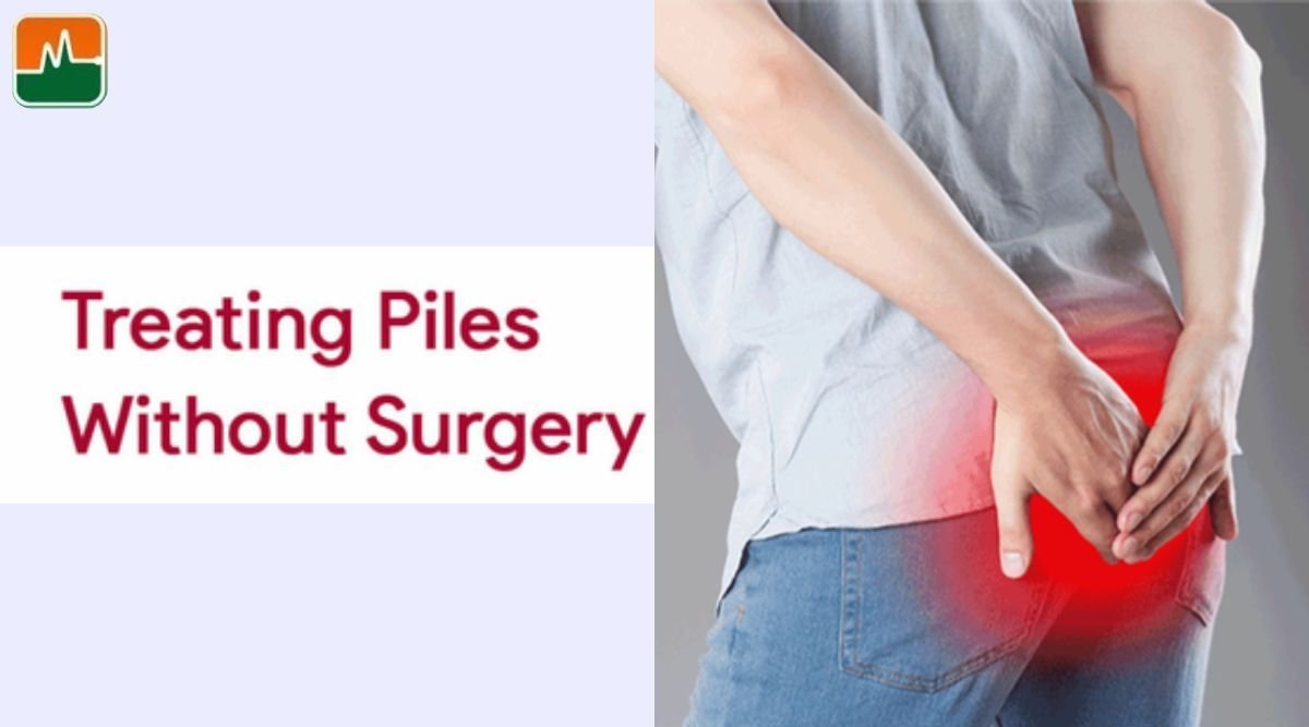 Piles Treatment Without Surgery in Greater Kailash