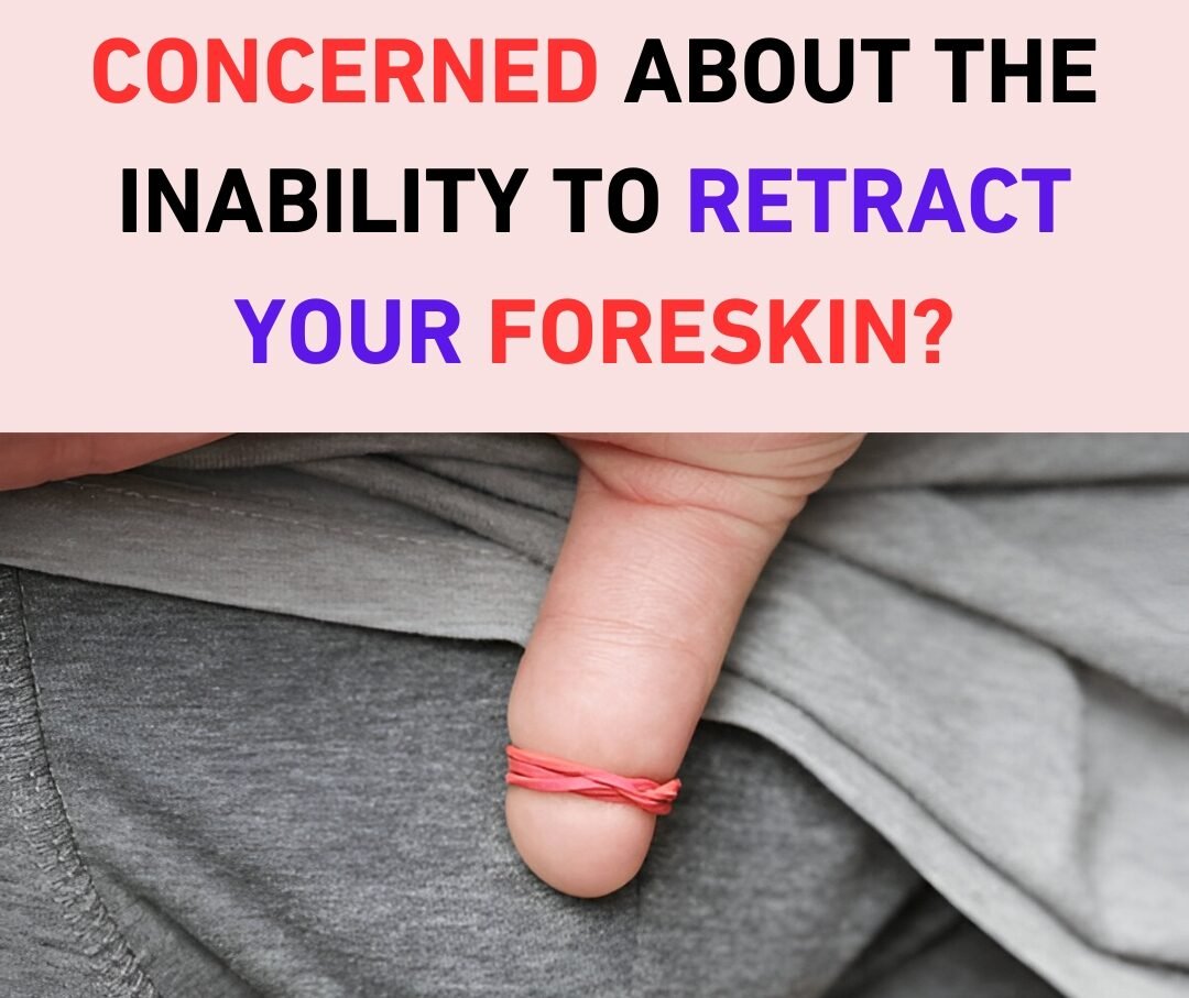 Is Phimosis a Cause of Erectile Dysfunction?