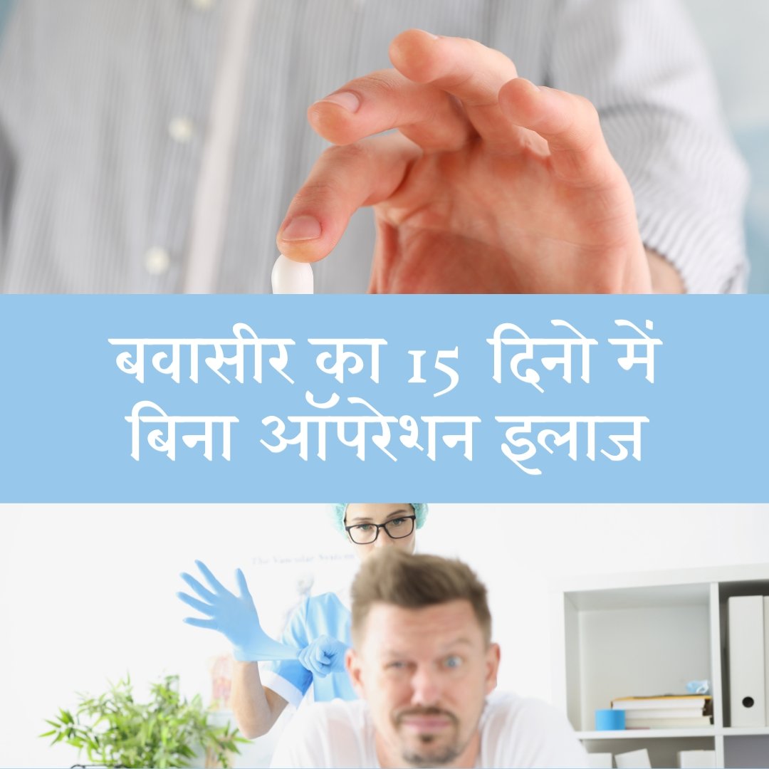 बवासीर का 15 दिनो में बिना ऑपरेशन इलाज