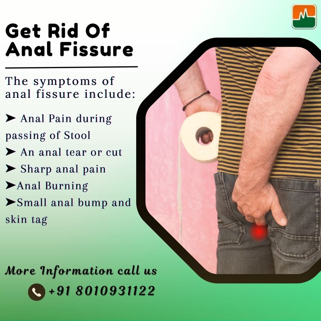 Fissure Doctor in Indirapuram