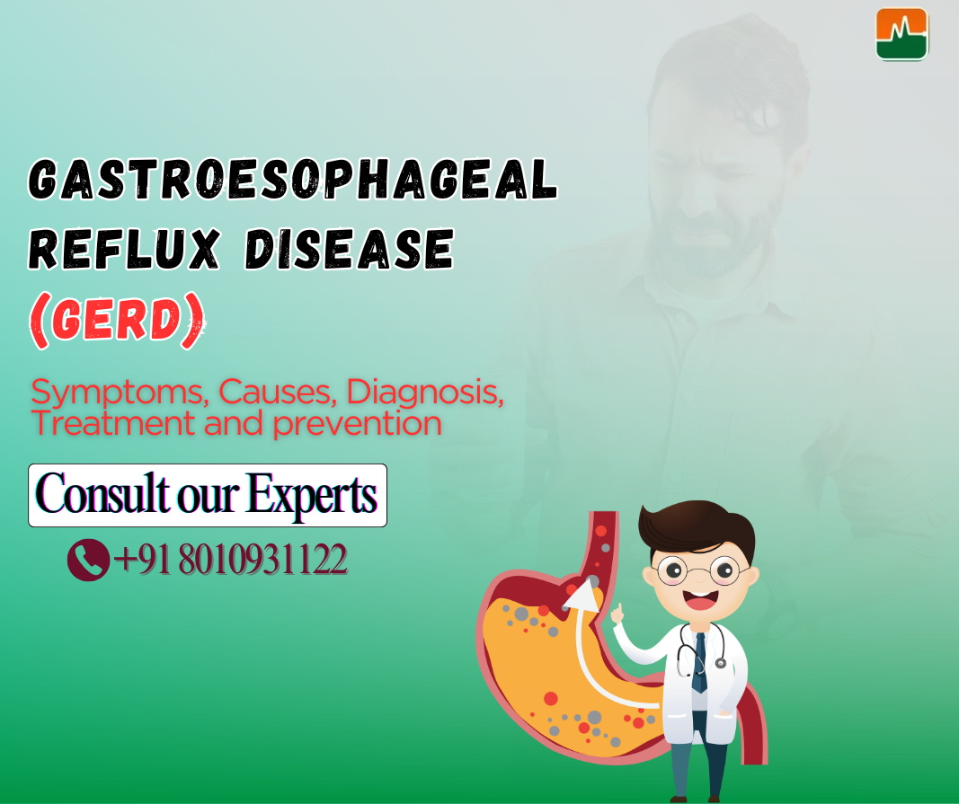 Gastroesophageal Reflux Disease
