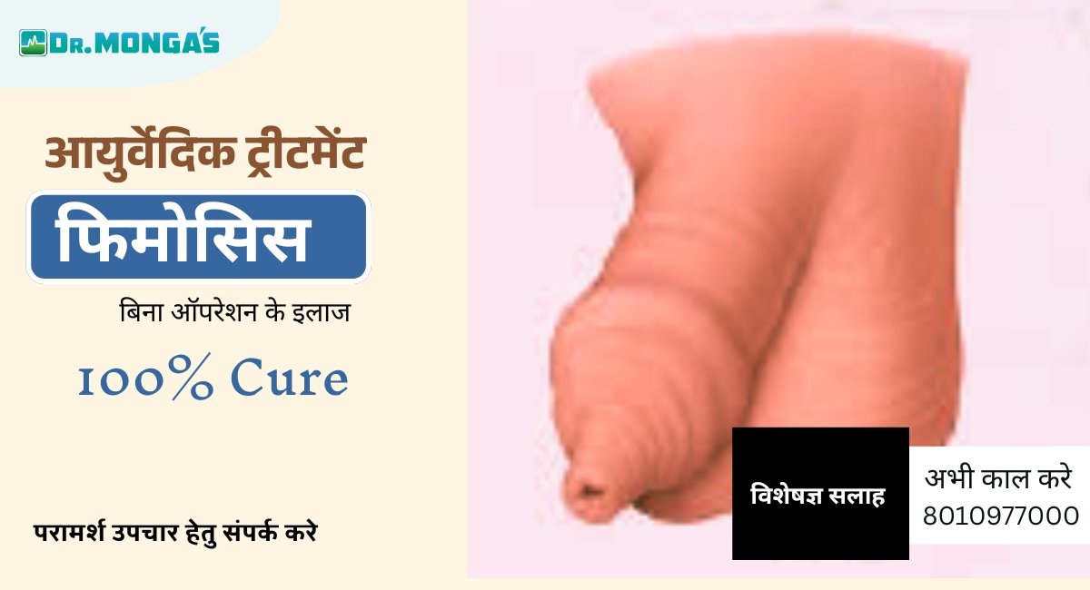 ayurvedic treatment for phimosis